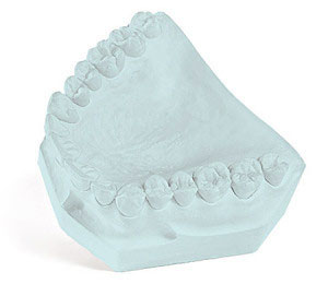 Garreco Labstone Blue Dental Model