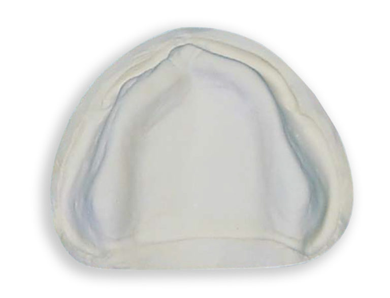 Easy dental model duplication technique using silicone – Garreco ...