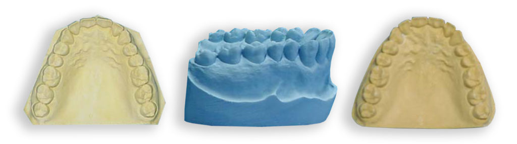 incorrect-models-for-duplication dental model duplication