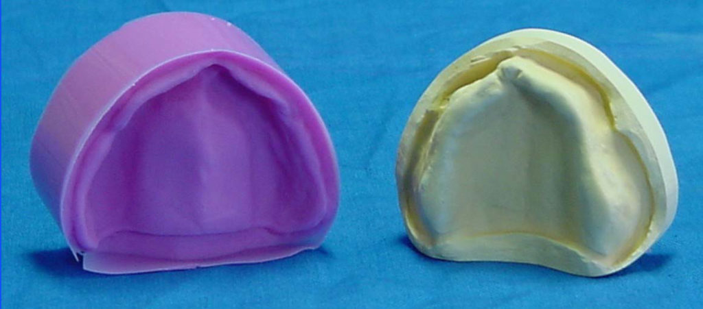 dental model duplication silicone-mold-gypsum-model