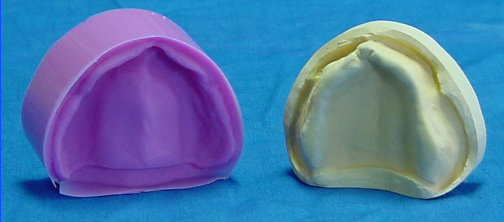 Easy dental model duplication technique using silicone Garreco