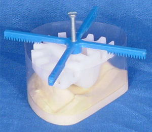silsaver-dupe-cross dental model duplication