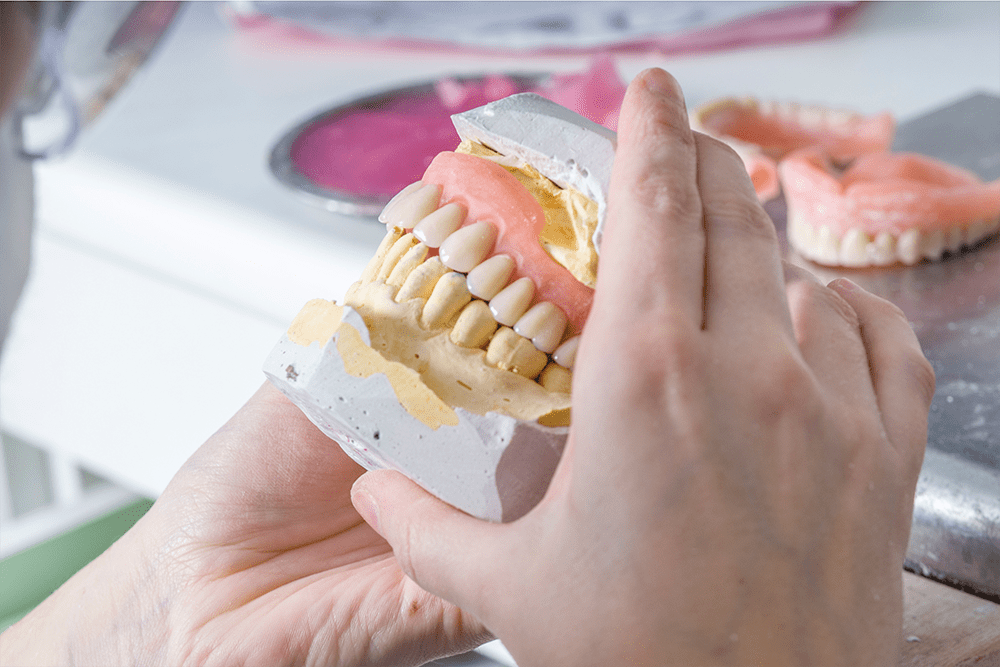 Acrylic denture on working gypsum model